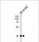 NKX1-1 Antibody (Center)